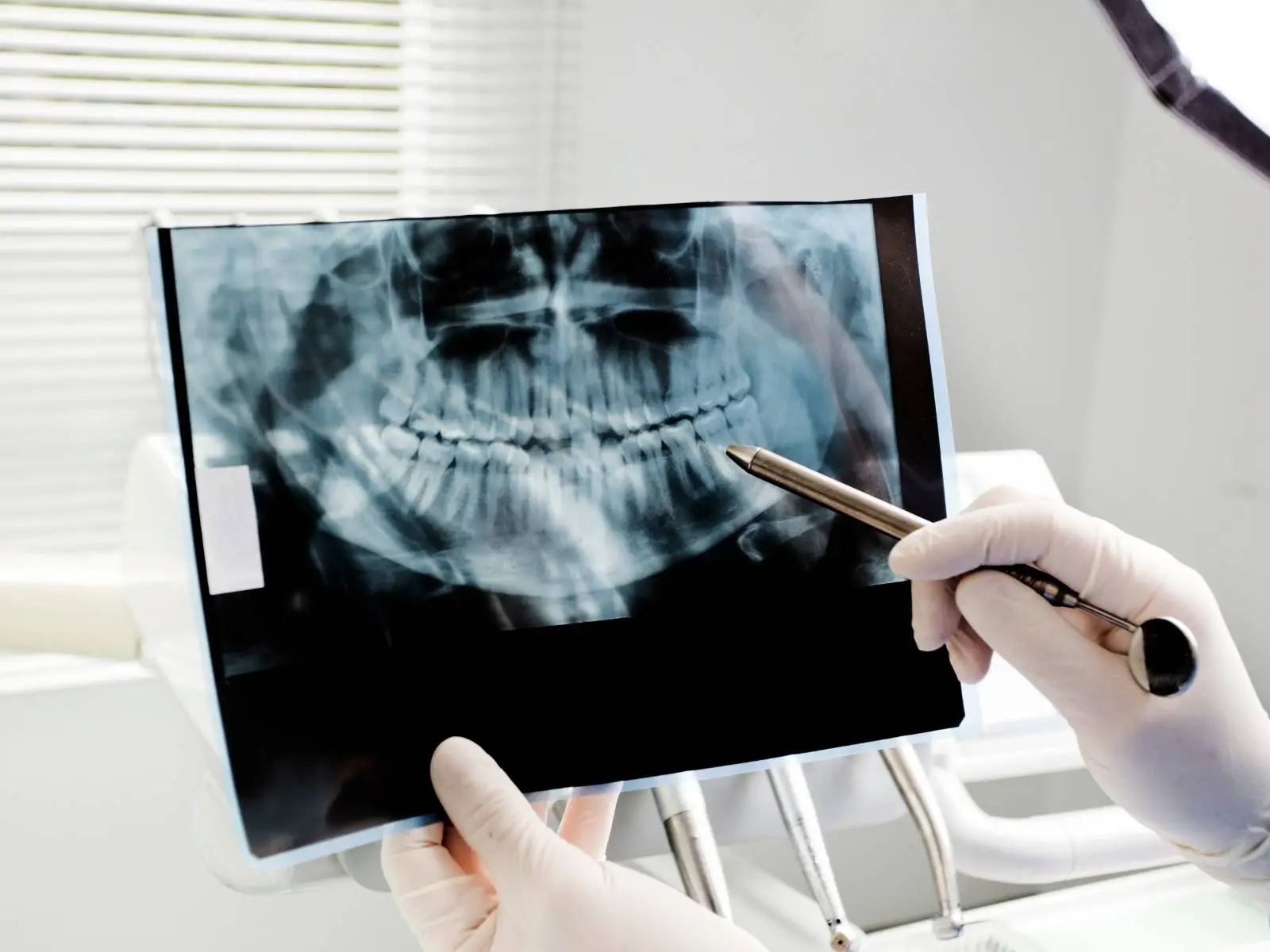 dental xray